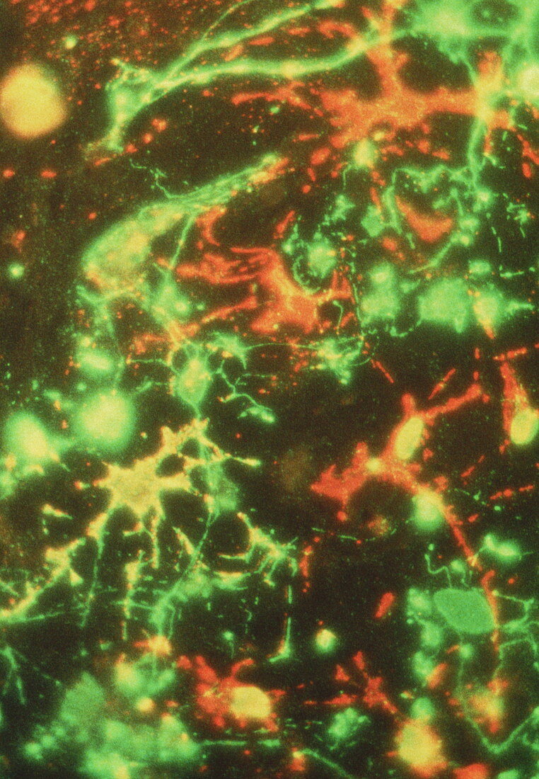 Fluorescence LM of oligodendrocyte nerve cells