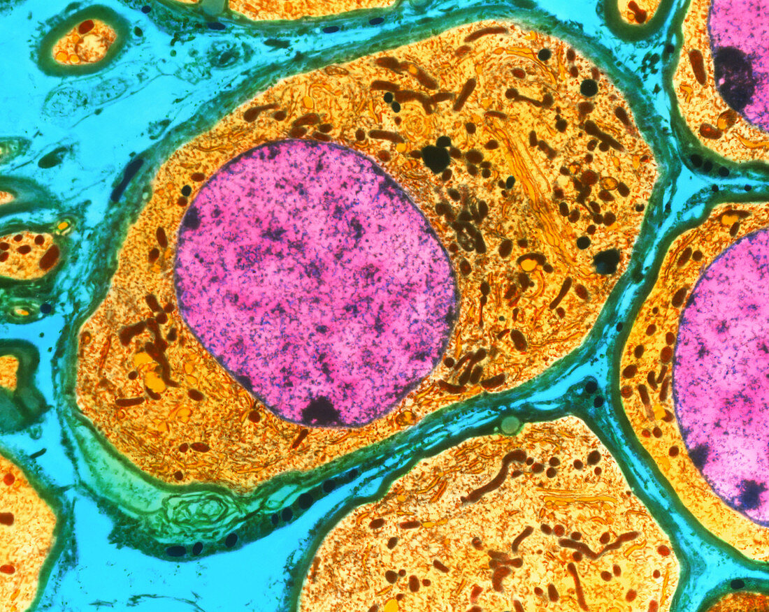 Coloured TEM of nerve cells in a human ganglion