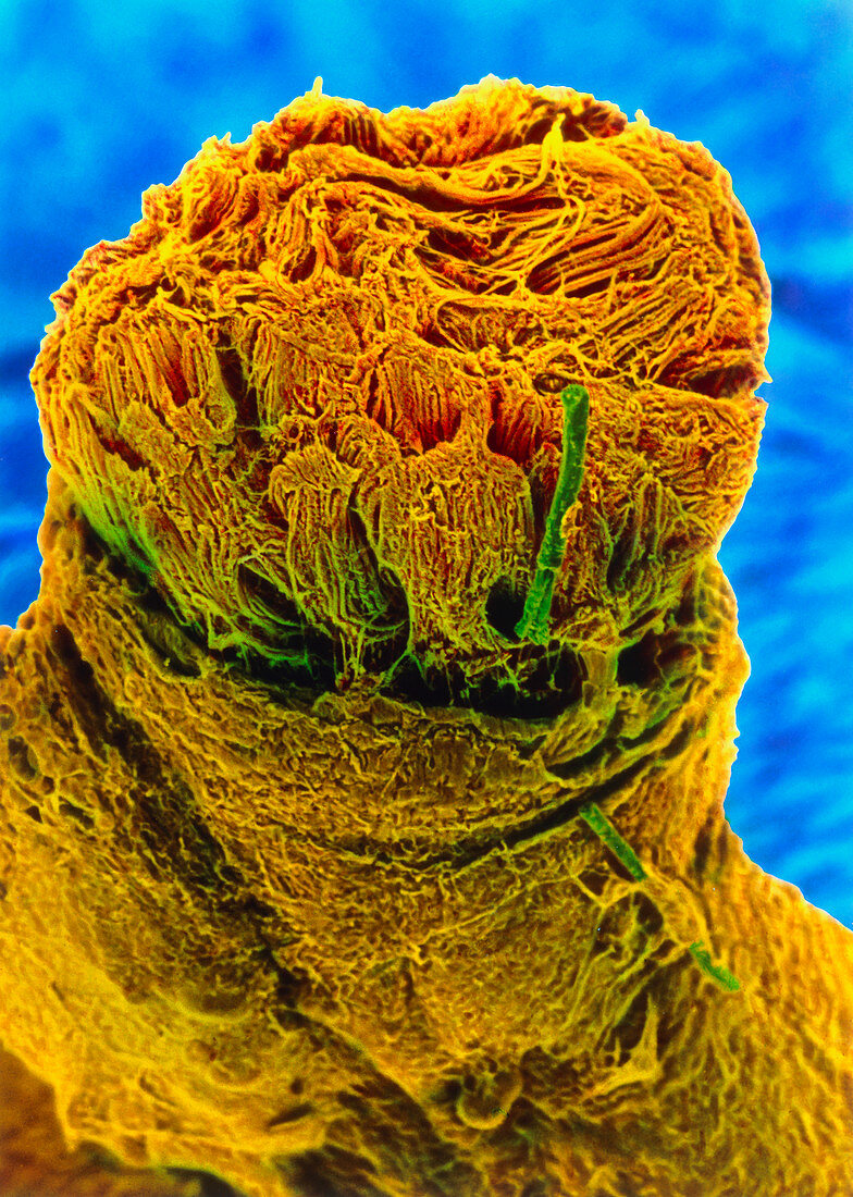 Coloured SEM of nerve fibres and perineurium
