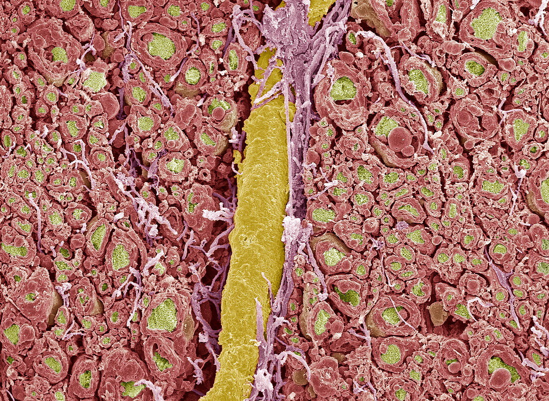 Myelinated nerve fibres,SEM