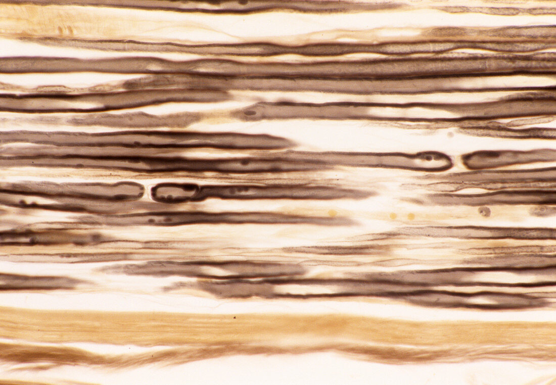 Myelinated nerves,light micrograph