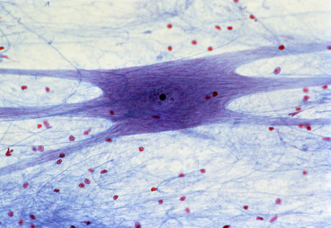 LM of a multipolar neurone from the spinal cord