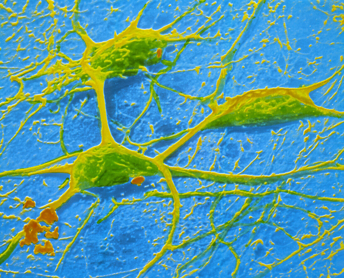False-colour SEM of 3 neurones of cerebral cortex