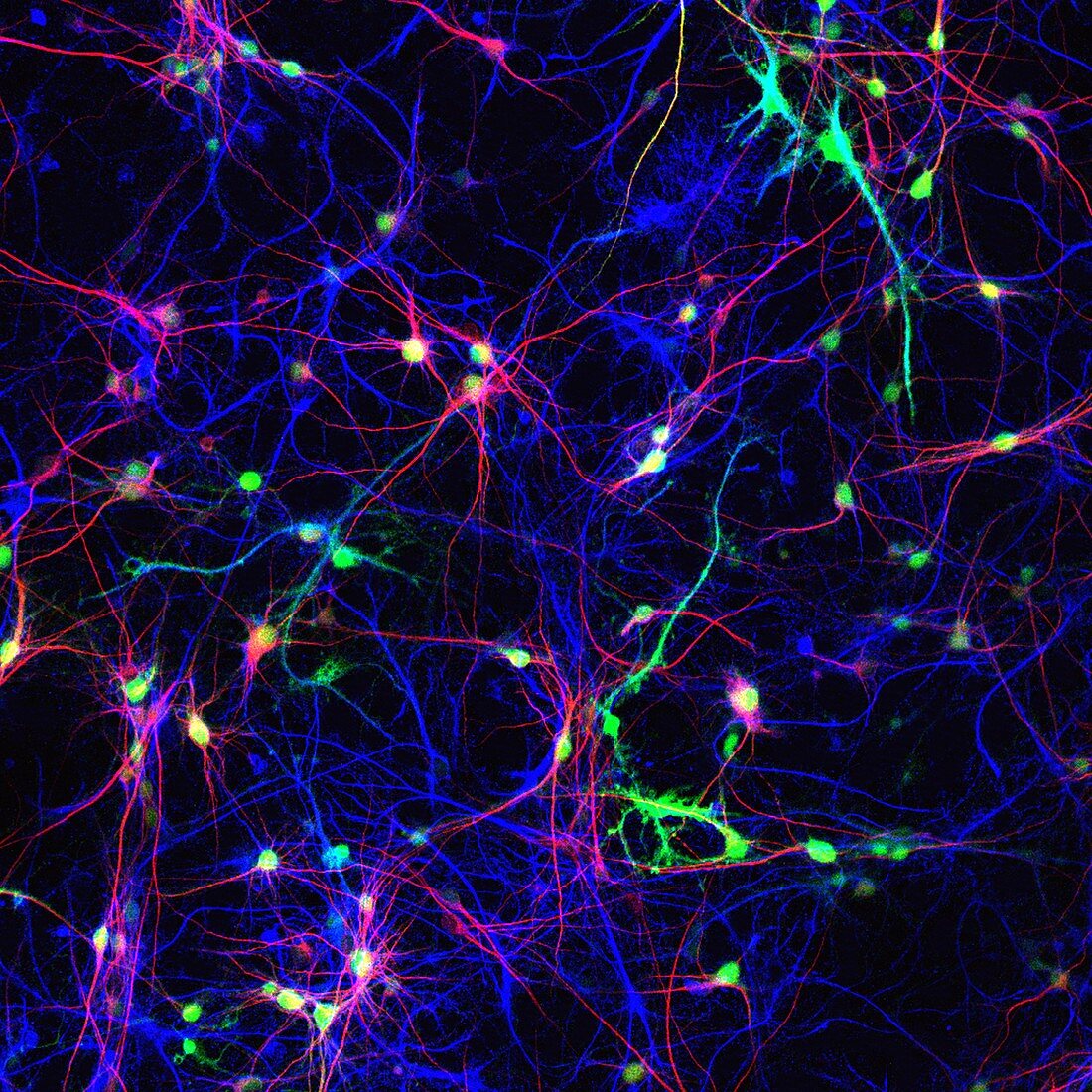 Brain nerve cells,light micrograph