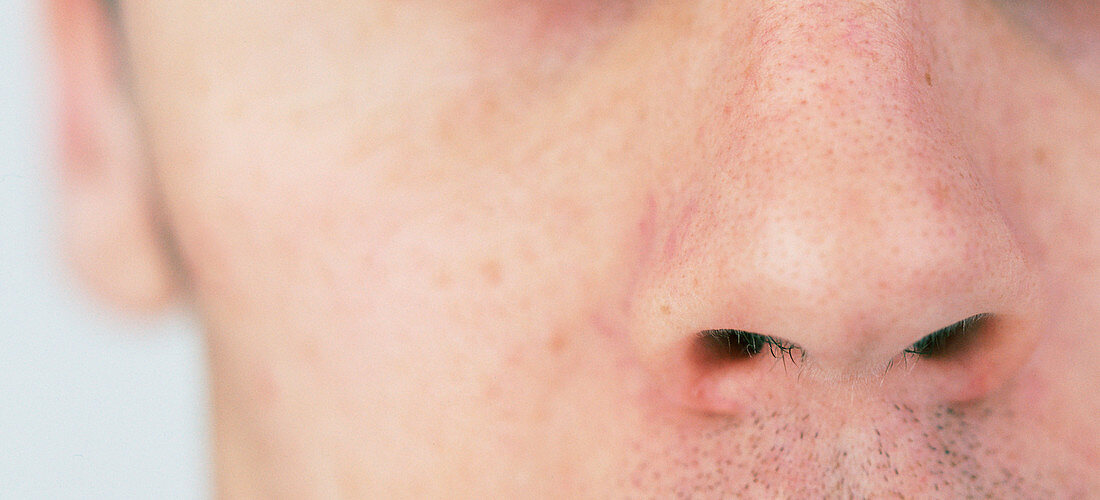 Man's nose