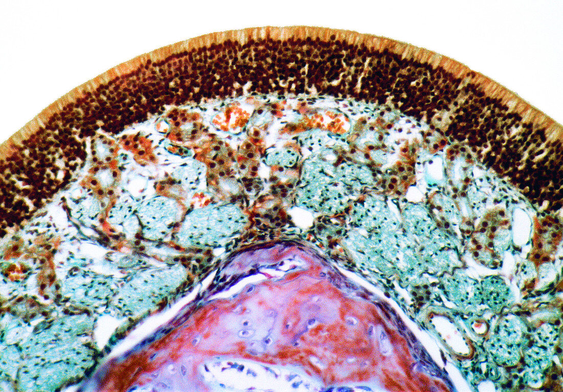 Nose mucosa,light micrograph