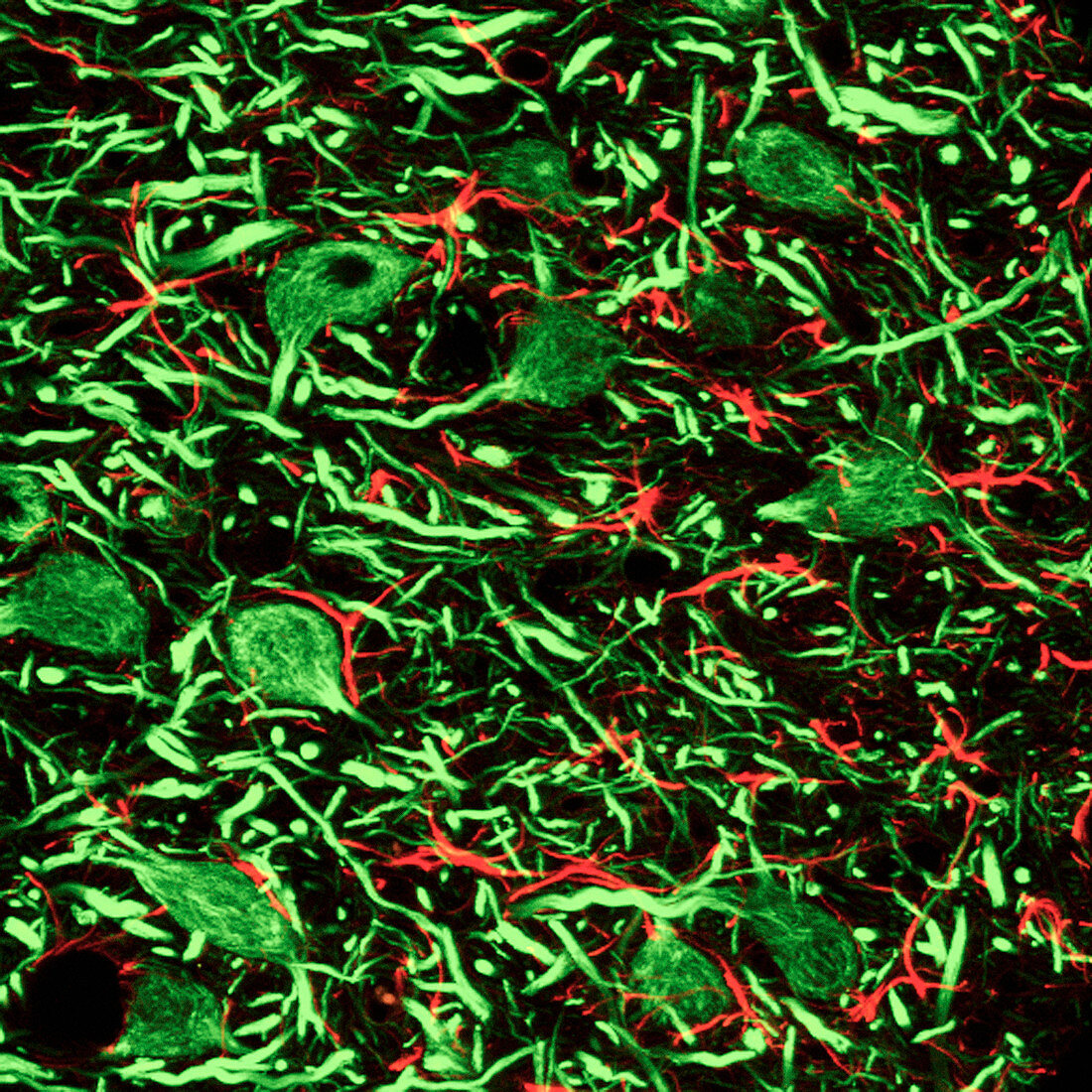 Thalamus nerve cells