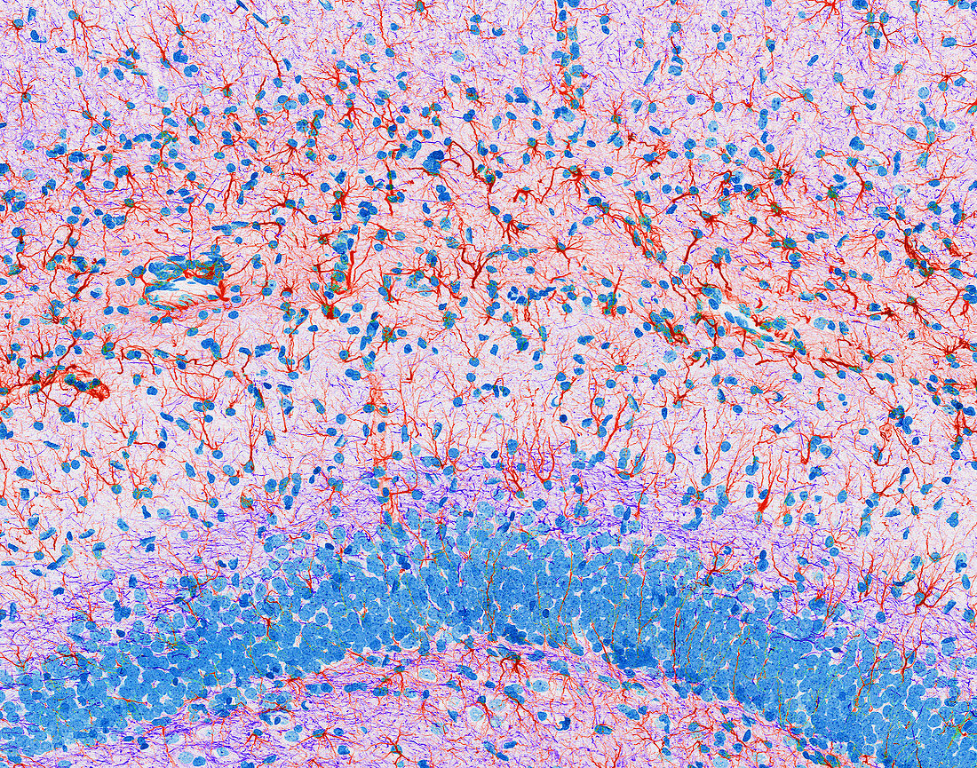 Hippocampus brain tissue