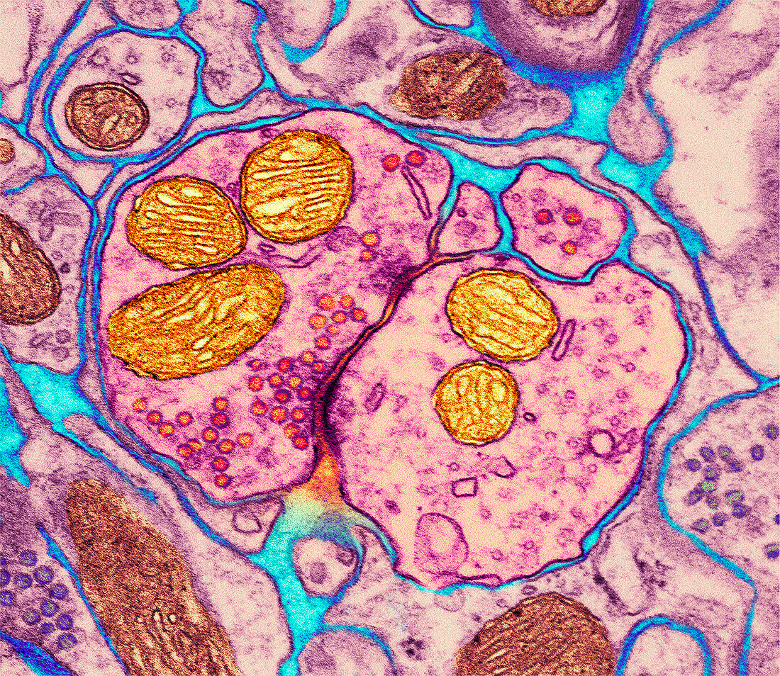 Synapse nerve junction,TEM