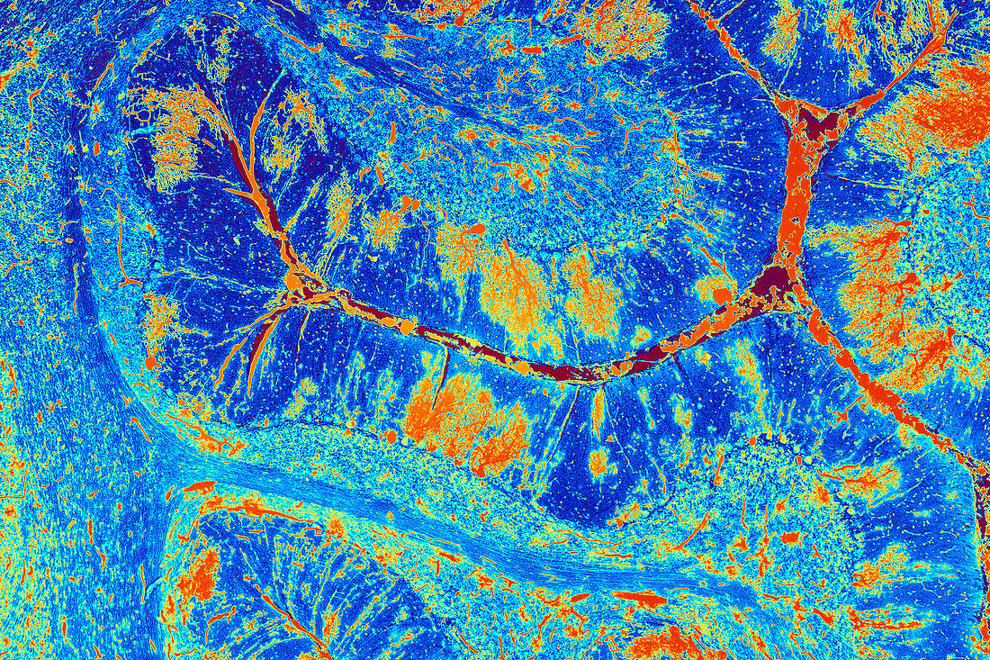 Cerebellum tissue,light micrograph