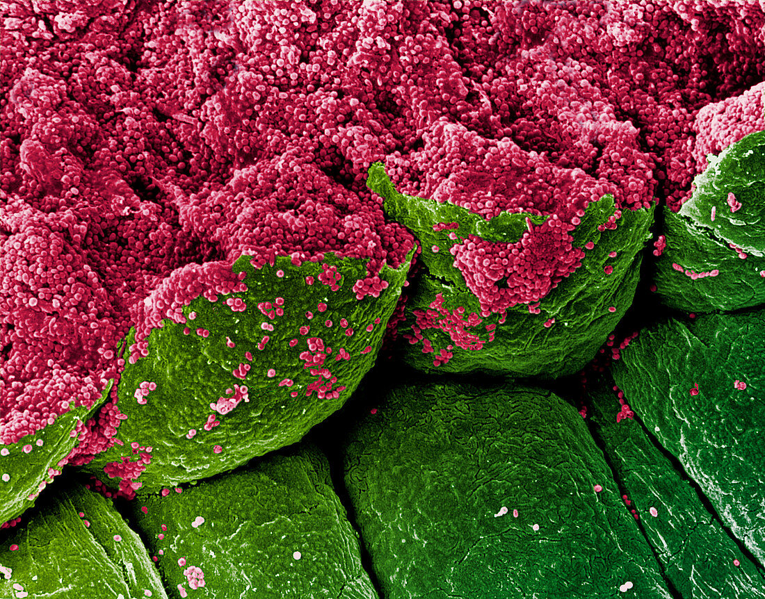 Coloured SEM of iris epithelial cells of the eye