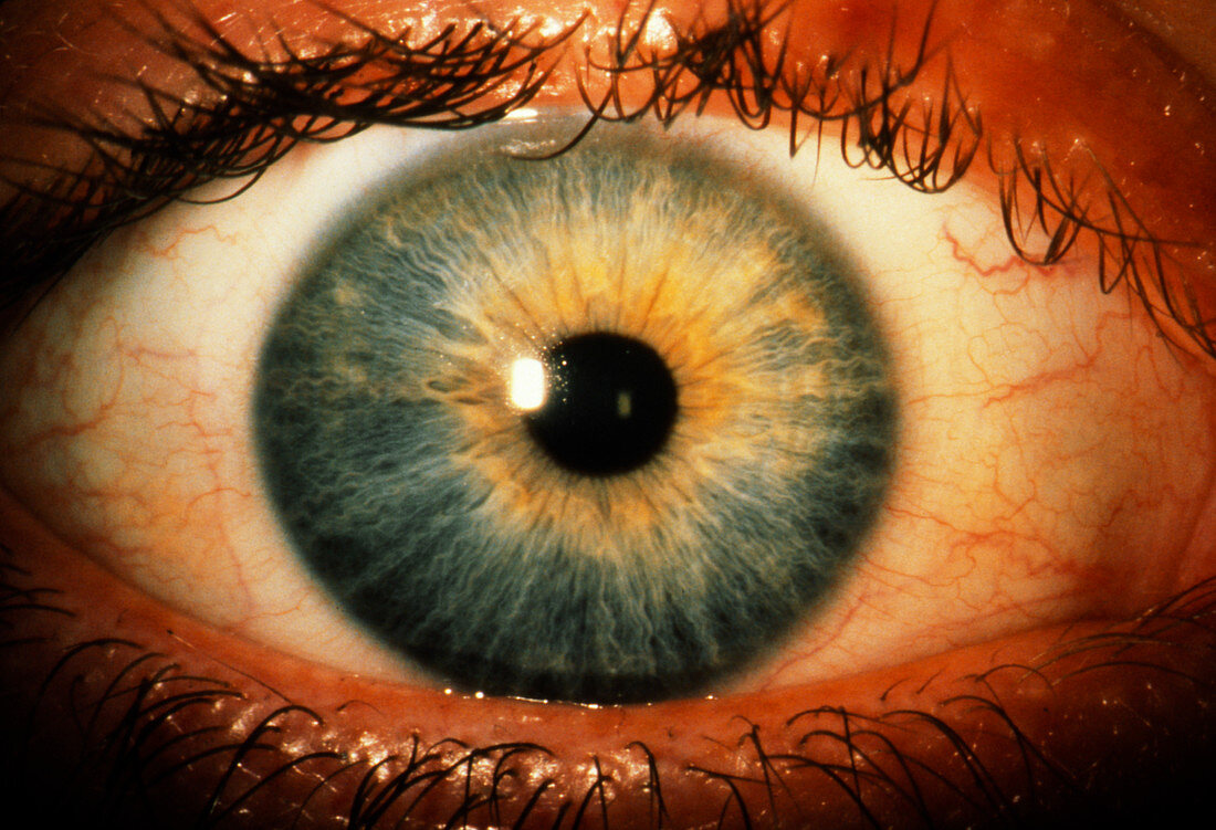 Close-up of a healthy,blue human eye