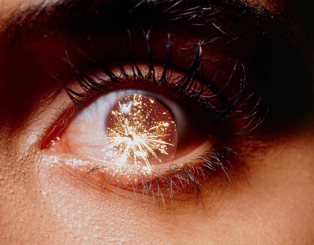 Abstract image of eye with fireworks in eyeball