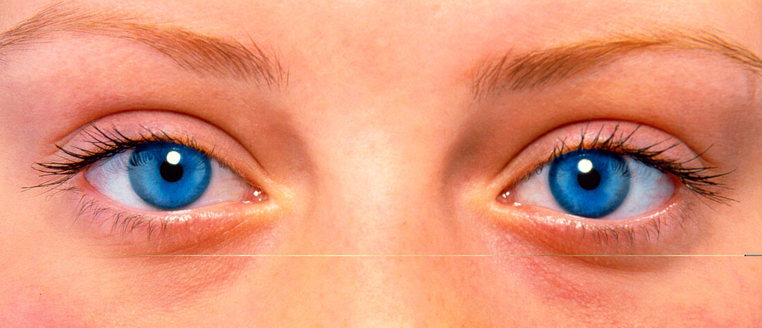 Close-up of woman's face showing her two blue eyes