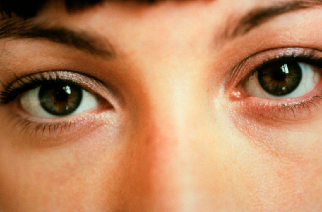 Woman's eyes