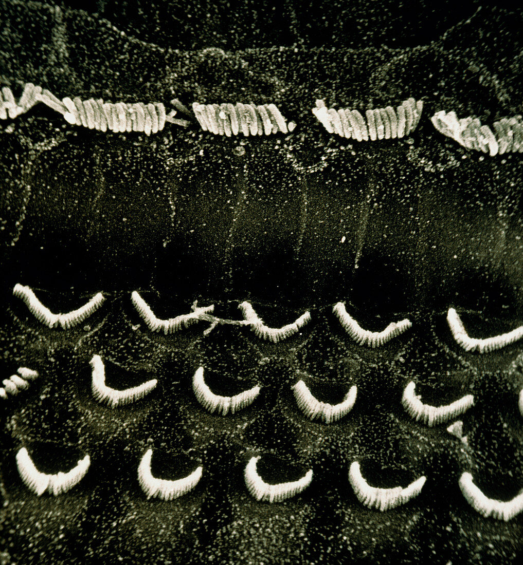 SEM of the surface of the organ of Corti