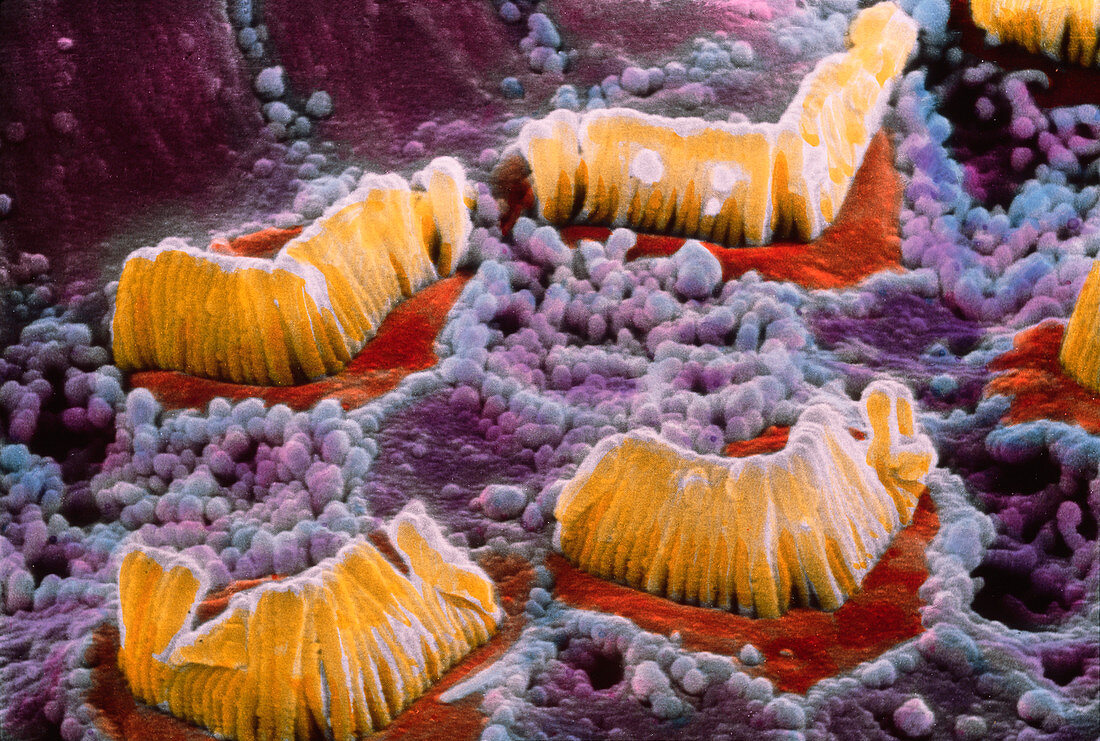SEM of hair cells in organ of Corti