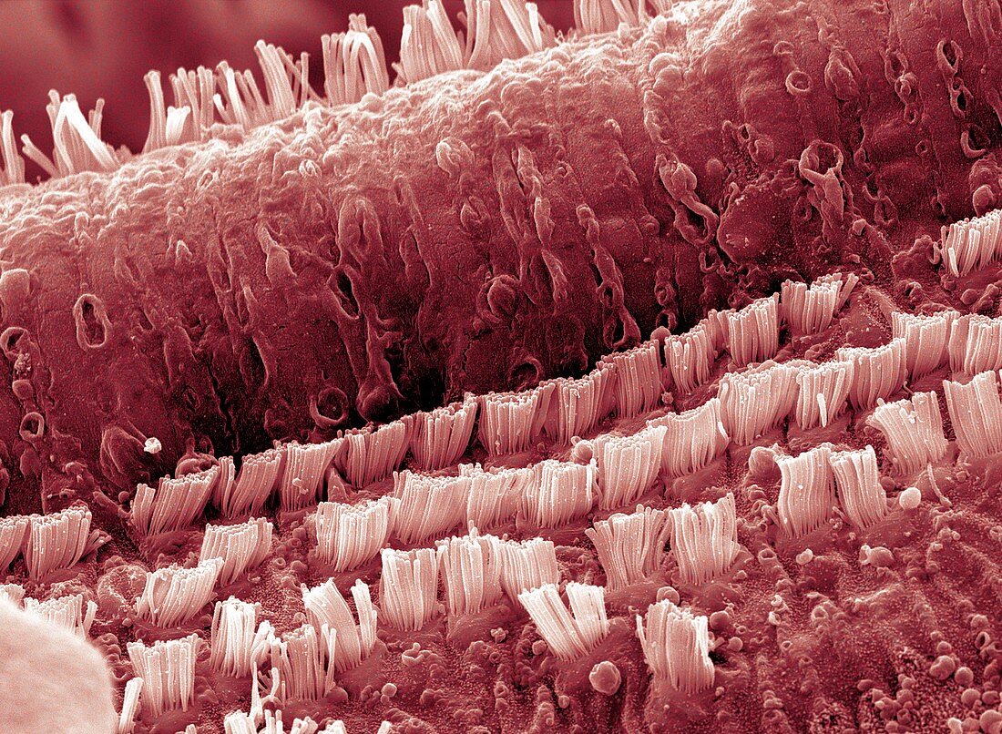 Cochlea cells,SEM