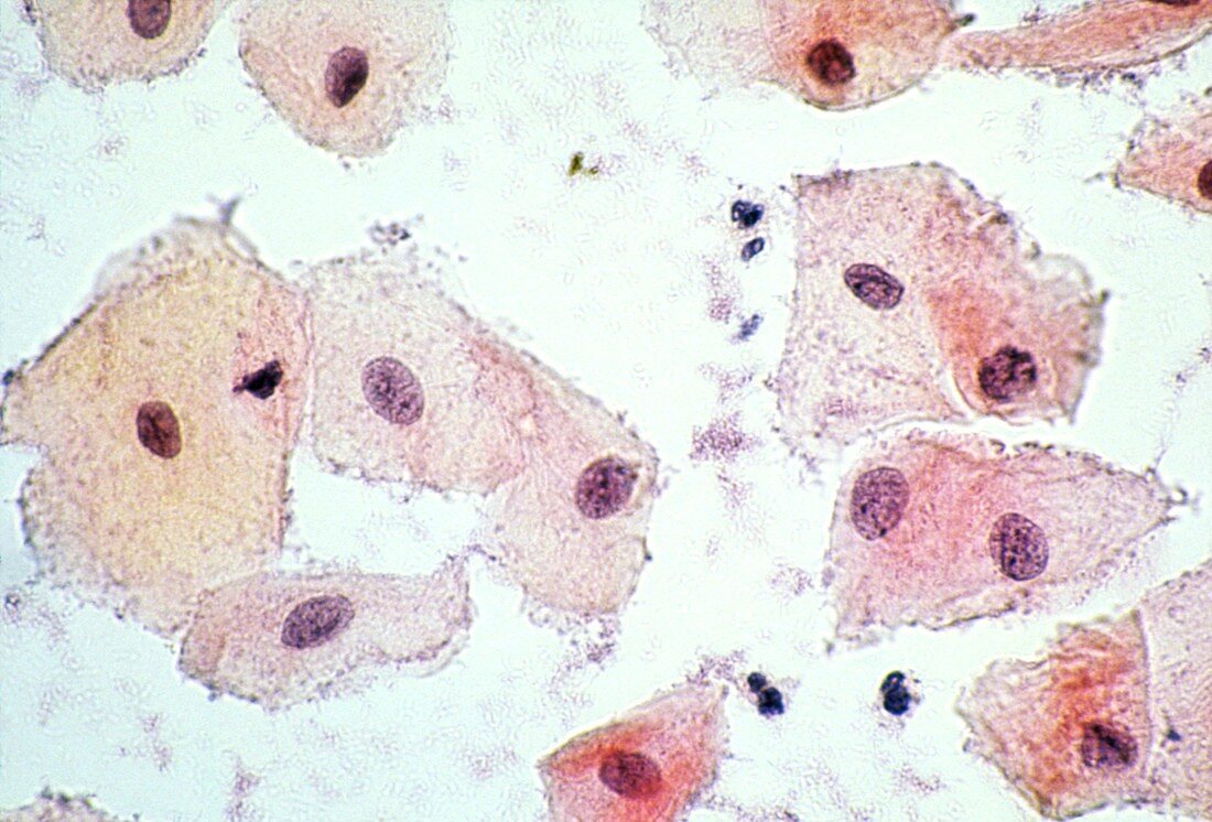 LM of epithelial cells from the human mouth
