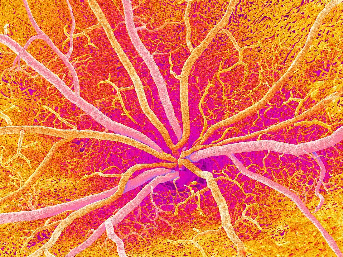 Retina blood vessels,SEM