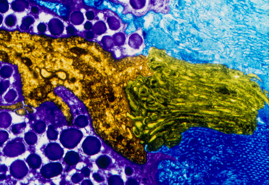 Colour TEM of photoreceptor cells in snail retina