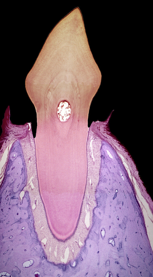 Incisor tooth,light micrograph