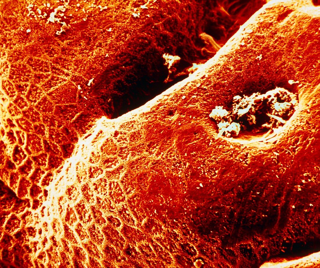 SEM of the human stomach mucosa