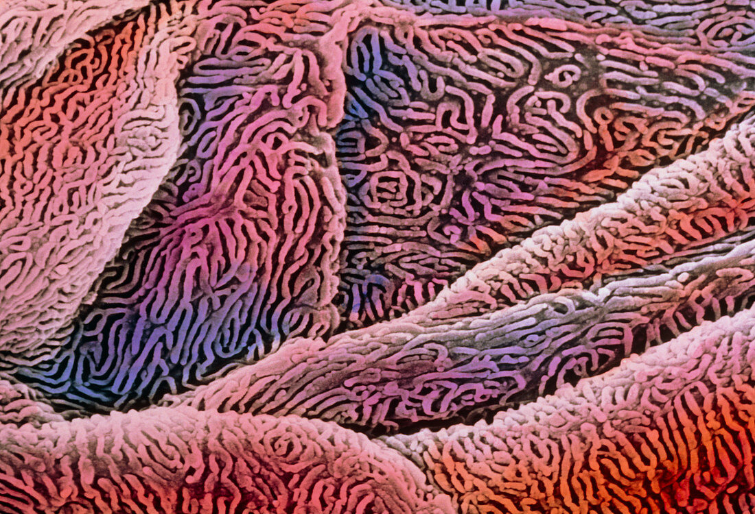 F/colour SEM of oesophagus-stomach transition zone