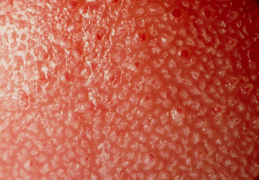 Macrophoto of surface of human tongue