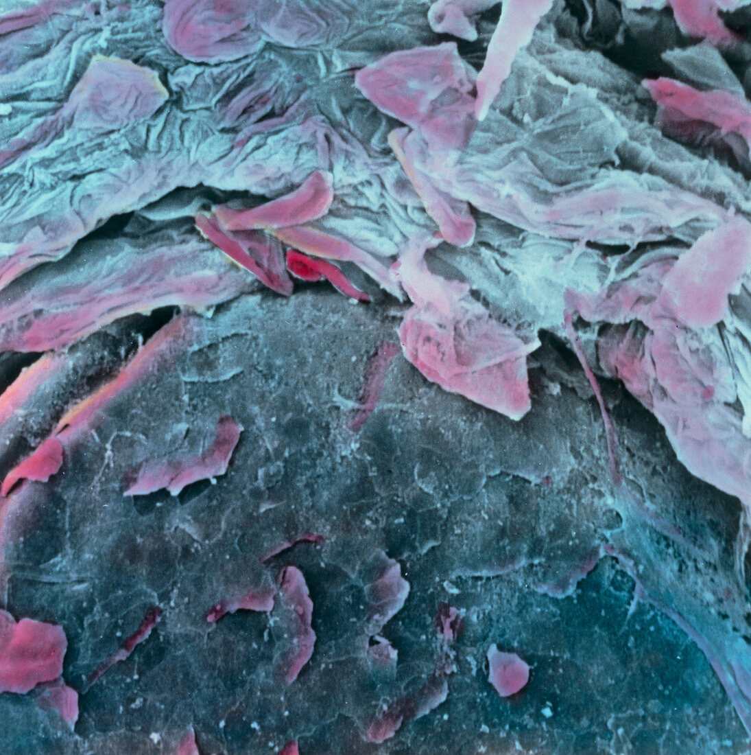 Coloured SEM of papillae on the tongue surface