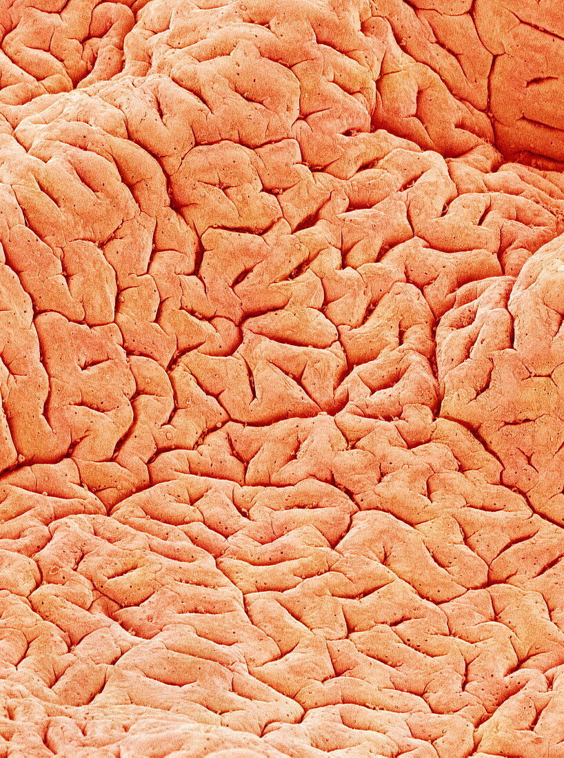 Mucous membrane in colon