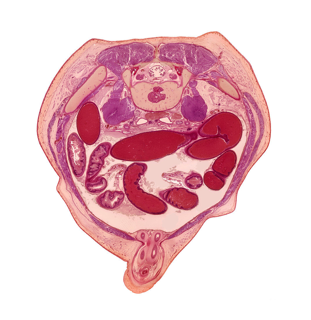 Foetal small intestines