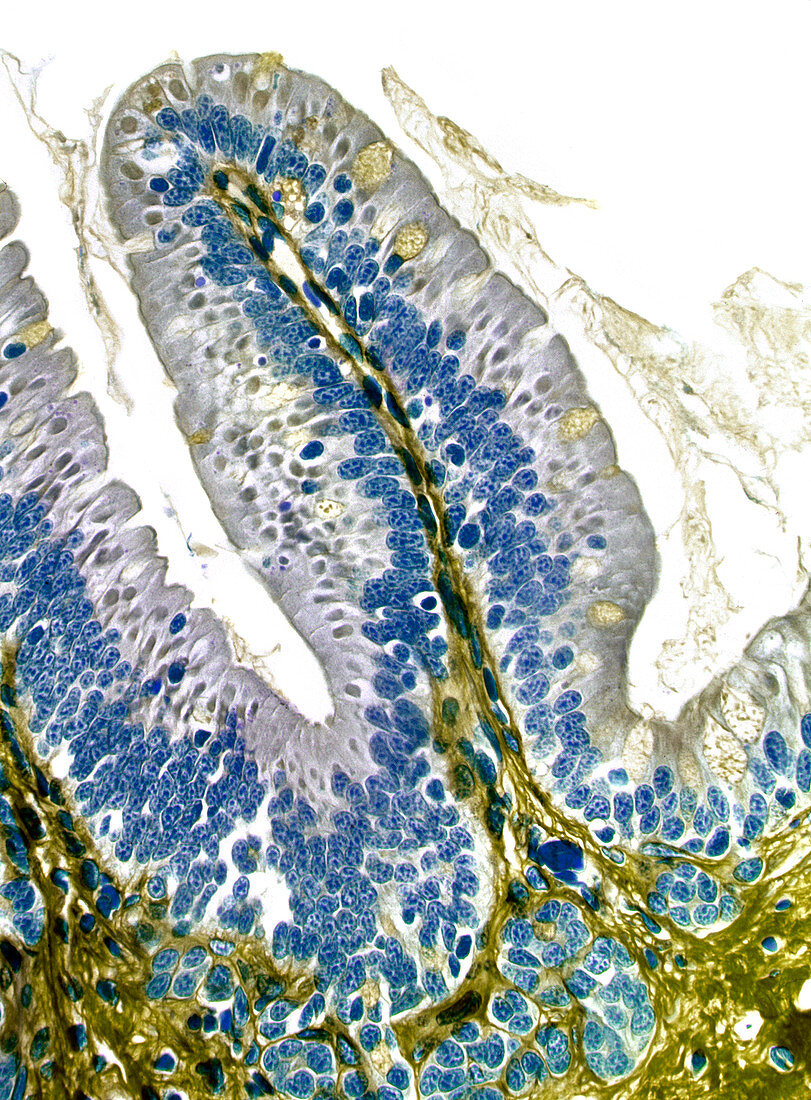 Intestinal villus,light micrograph