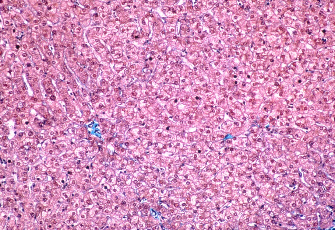 LM of human liver