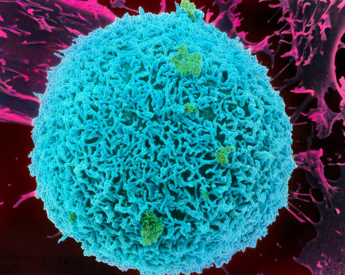Coloured SEM of a liver cell (hepatocyte)