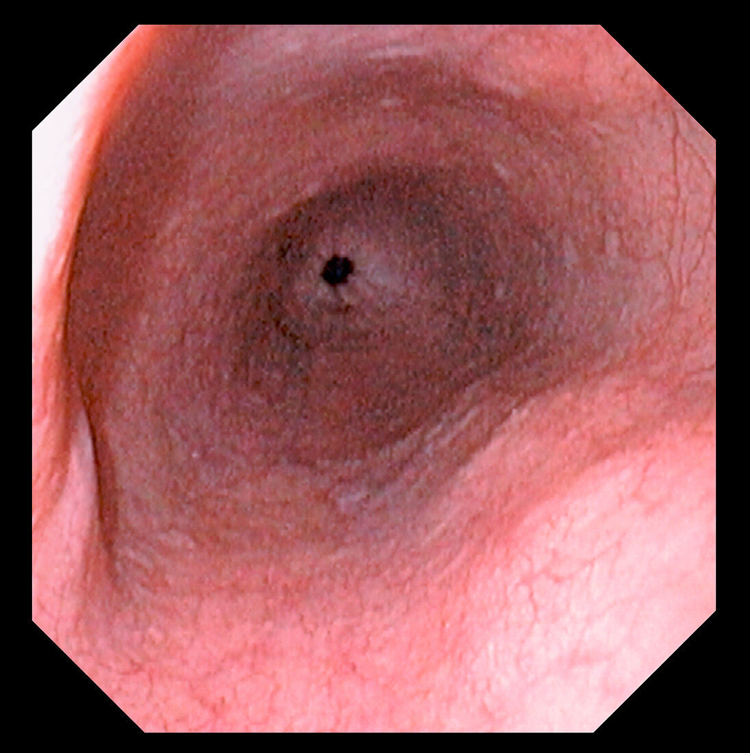 Oesophagus