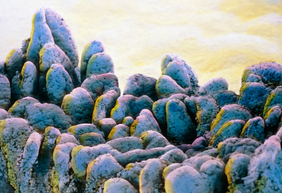 False-colour SEM of villi in the duodenum