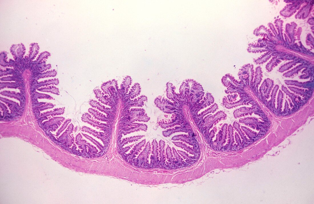LM of a section through the human small intestine