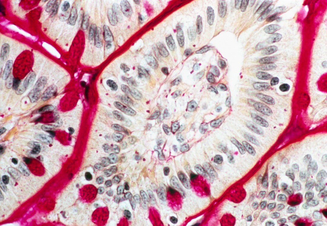 LM of an intestinal villus in cross section