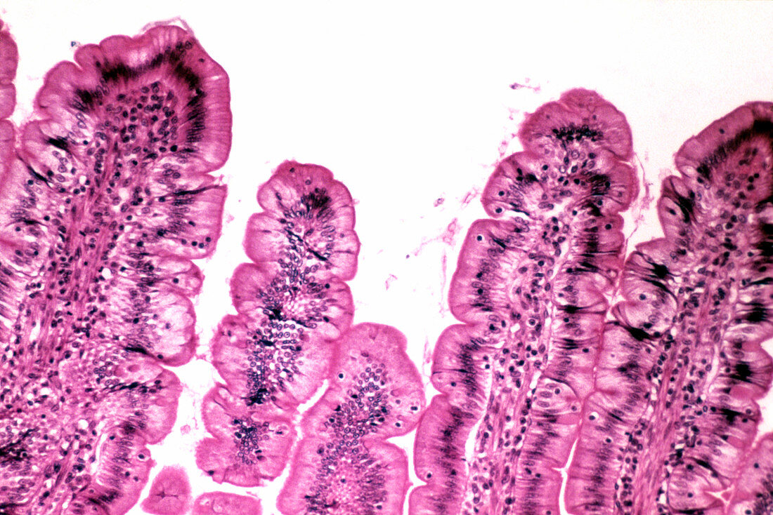 LM of a section through tips of intestinal villi
