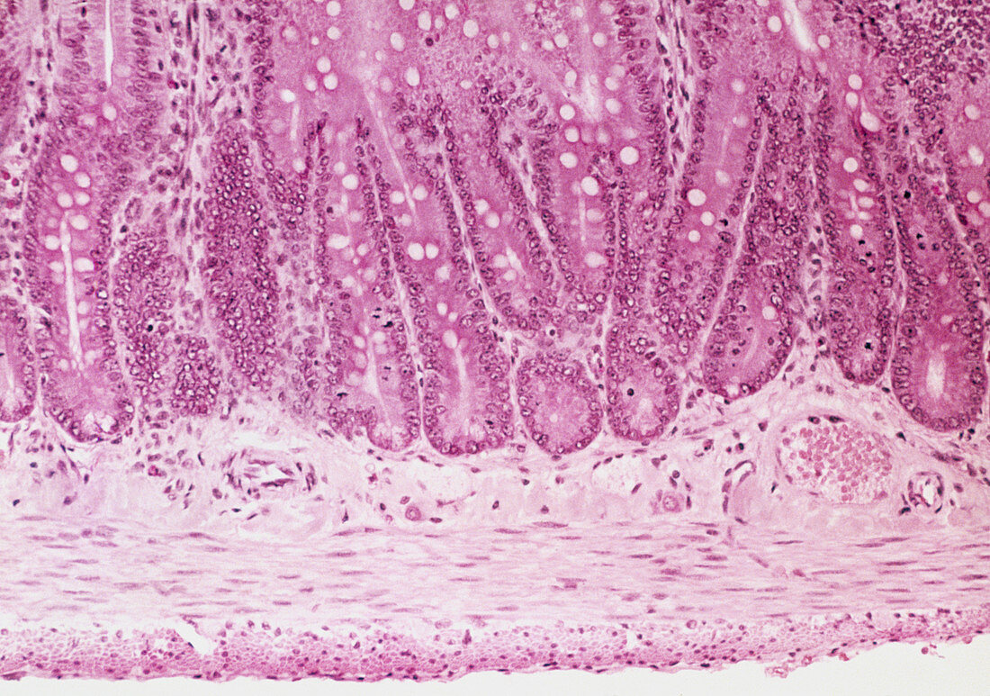 LM of a section through the small intestine wall