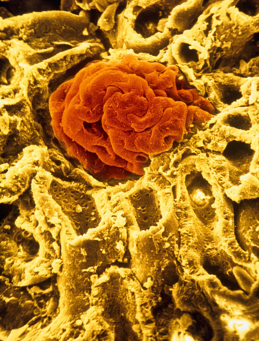 False-colour SEM of a human kidney glomerulus