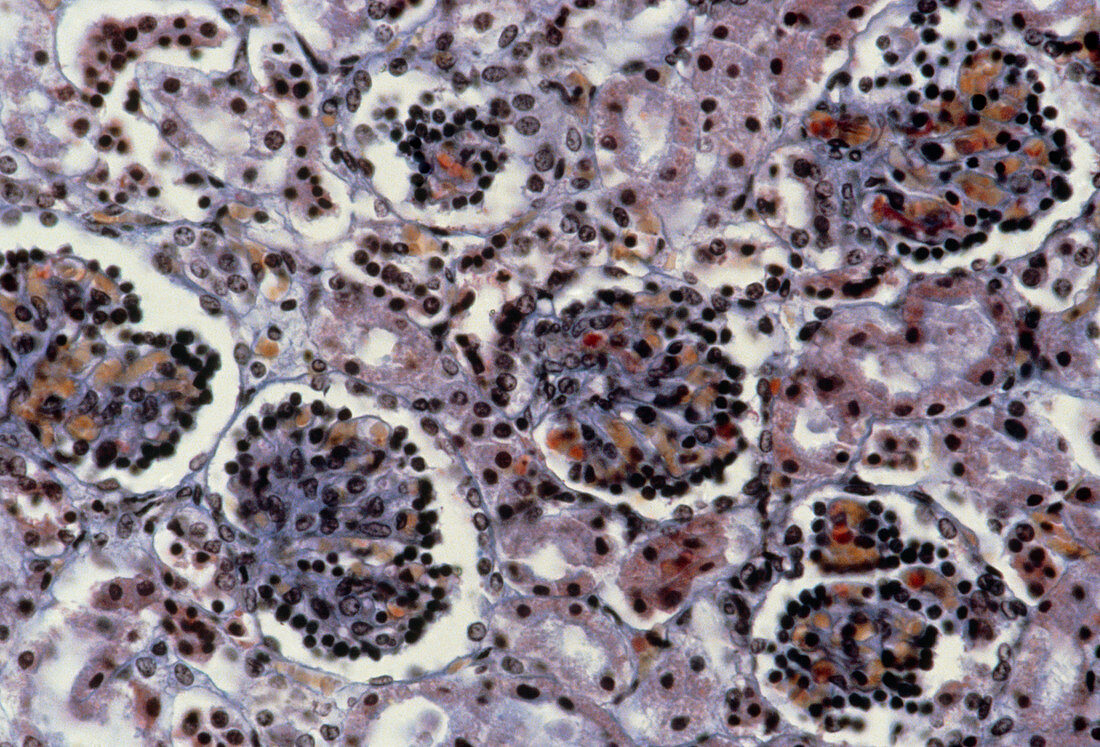 LM of a baby's kidney showing several glomeruli