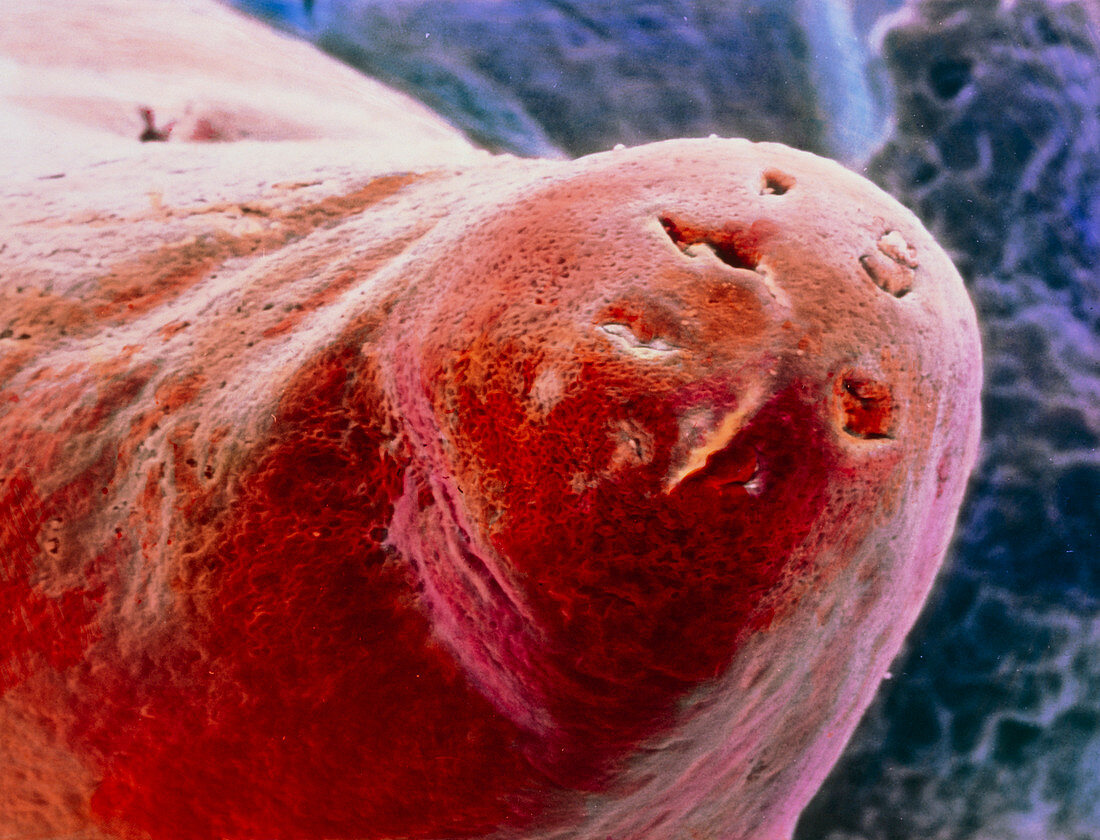 False-colour SEM of a kidney papilla