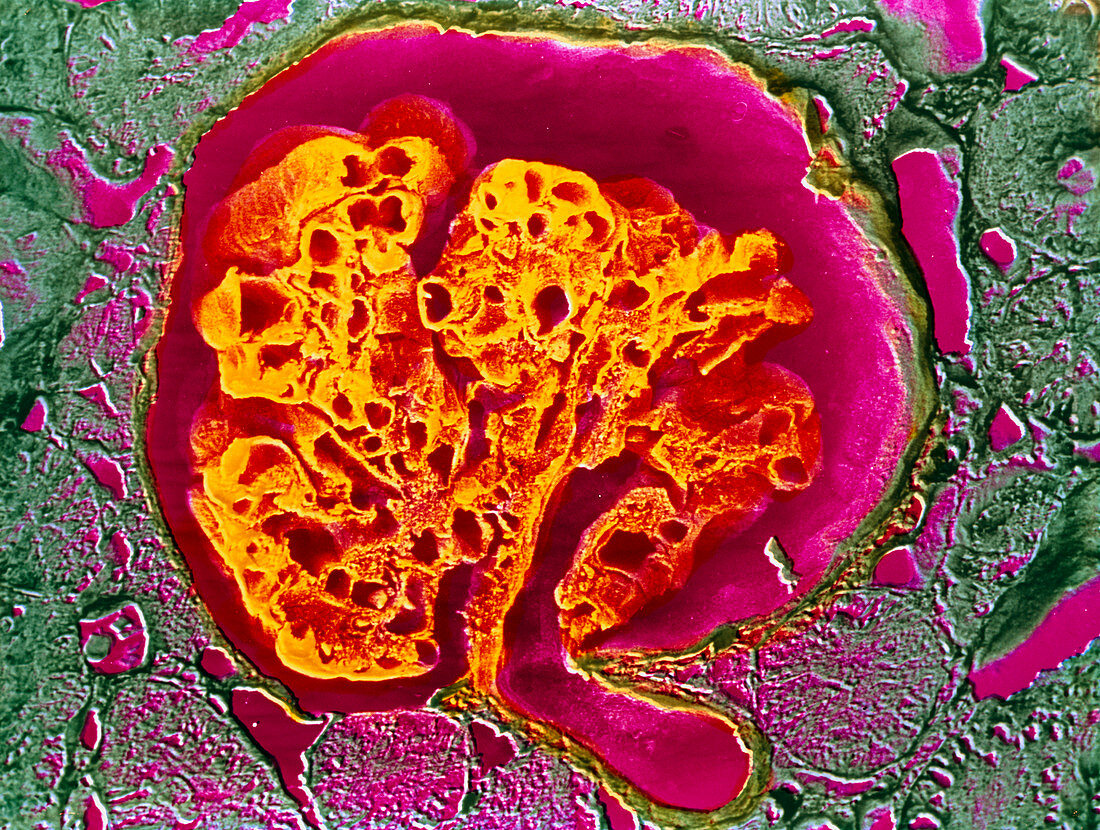 Coloured SEM of a renal glomerulus