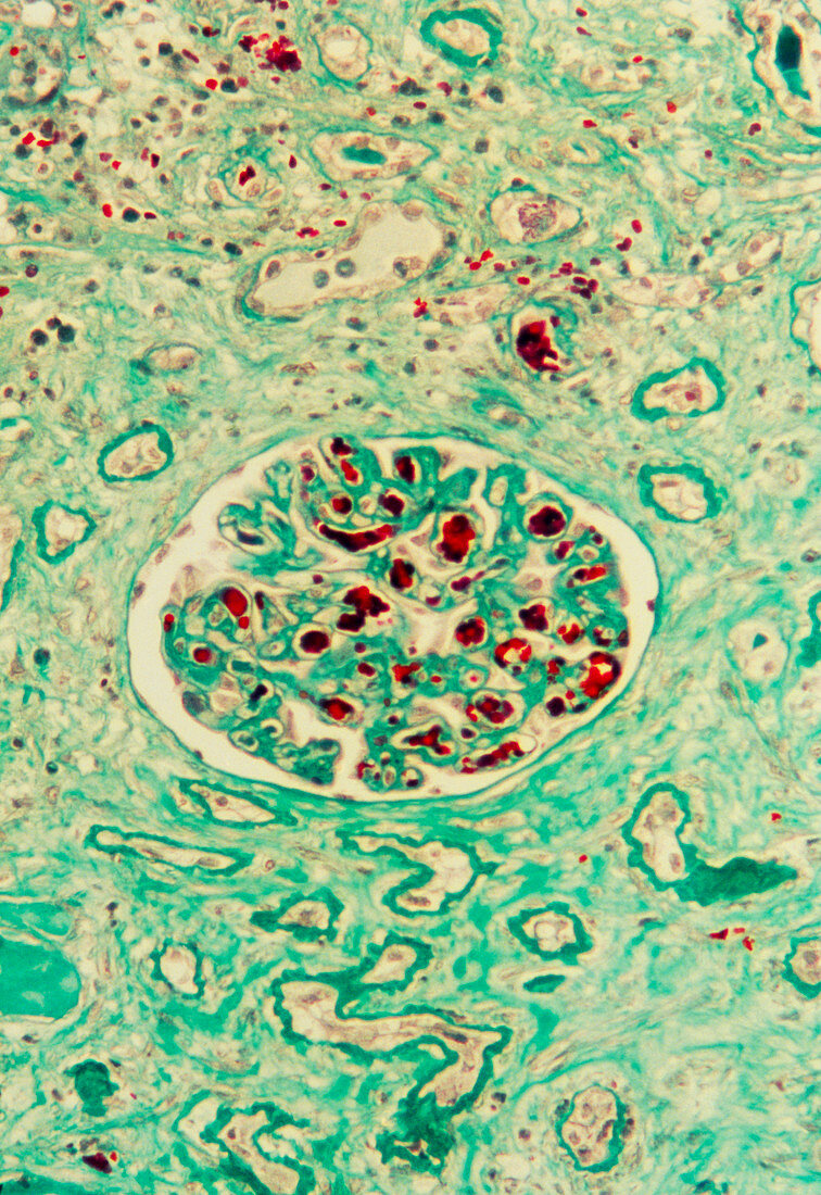 Kidney glomerulus
