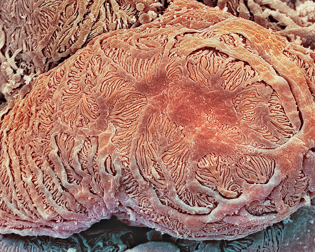 Kidney glomerulus,SEM