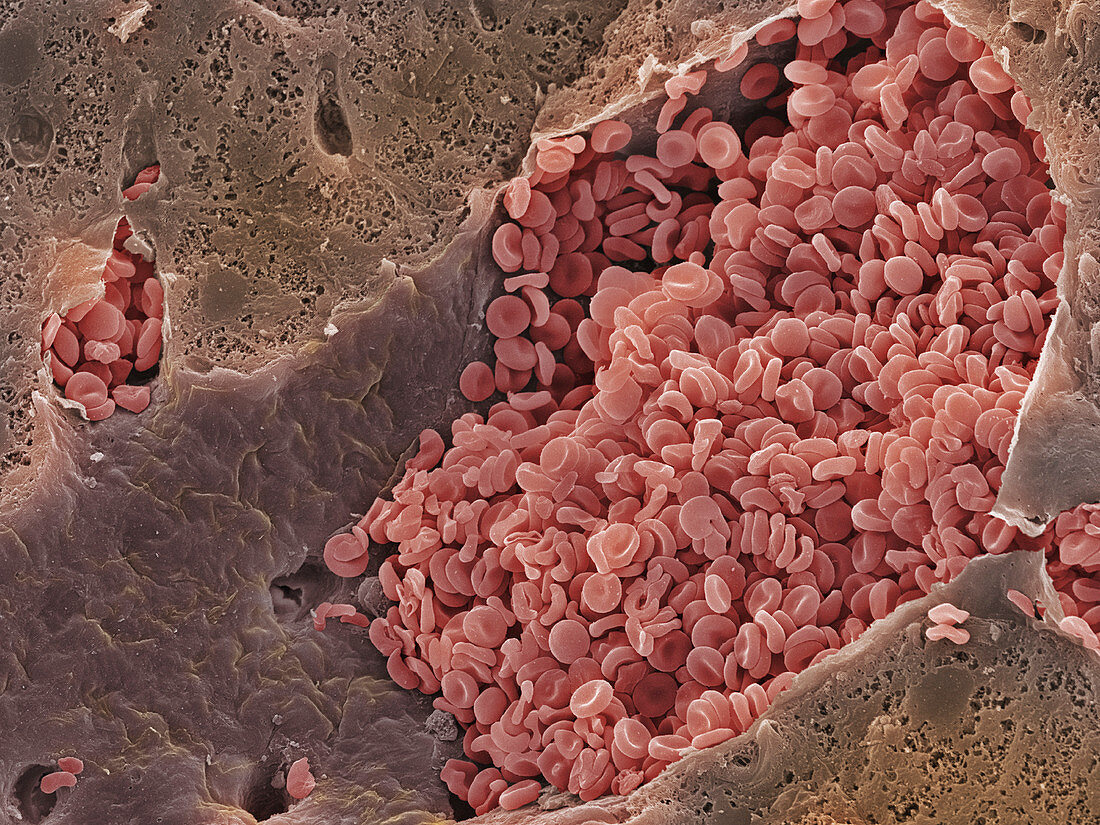 Liver vein,SEM