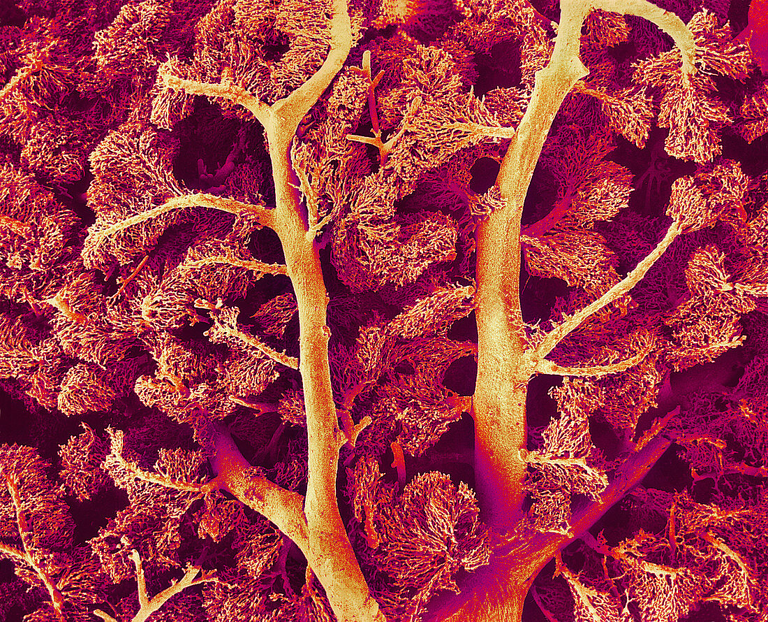 Liver blood vessels,SEM