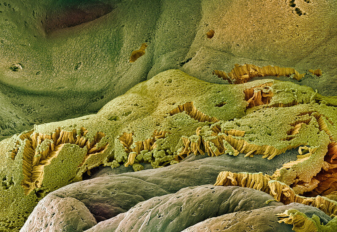 Gall bladder surface,SEM